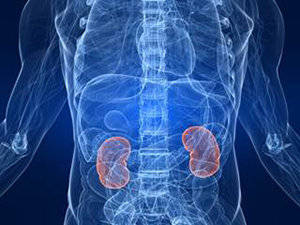 cancer renal